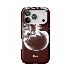 Crimson Cranium iPhone Case