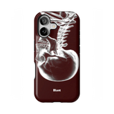 Crimson Cranium iPhone Case