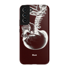 Crimson Cranium Samsung Case
