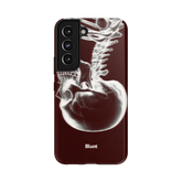 Crimson Cranium Samsung Case