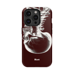 Crimson Cranium iPhone Case