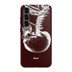 Crimson Cranium Samsung Case