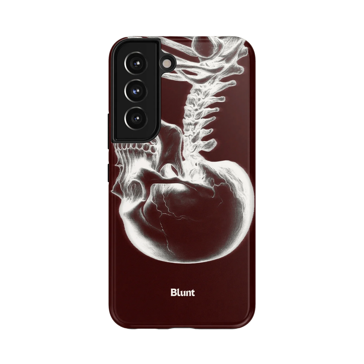 Crimson Cranium Samsung Case