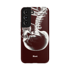 Crimson Cranium Samsung Case